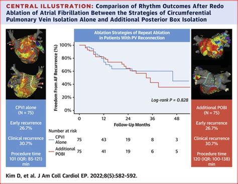 electrical posterior box isolation in repeat abation|Electrical Posterior Box Isolation in Persistent Atrial .